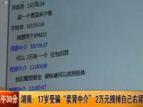 17岁女生4个肾图片_WWW.66152.COM